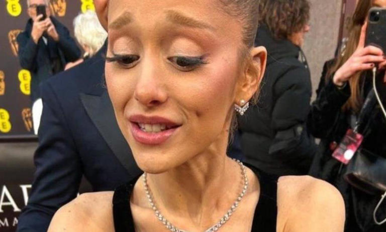 Ανησυχία στις τάξεις των θαυμαστών της Αριάνα Γκράντε μετά την εμφάνισή της στα βραβεία BAFTA