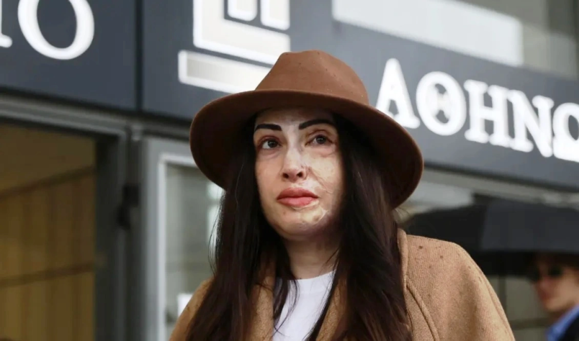 Ιωάννα Παλιοσπύρου: Γίνεται ντοκιμαντέρ η ζωή της και η επίθεση με βιτριόλι