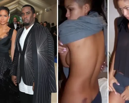 Σοκάρουν οι φωτογραφίες της Κάσι Βεντούρα από ξυλοδαρμούς του “Diddy”: Το ματωμένο φρύδι, οι μελανιές και η μαρτυρία της