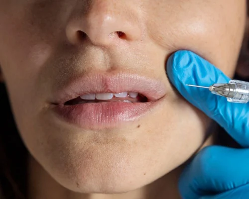 ΒΙΝΤΕΟ: «Botox Party» σε σπίτια και ενέσιμα σε κομμωτήρια