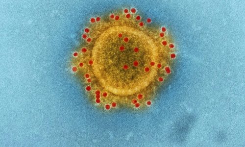 Το Ινστιτούτο Παστέρ προειδοποιεί: «Πανδημία χειρότερη της COVID αν μεταλλαχθεί ο ιός της γρίπης των πτηνών»