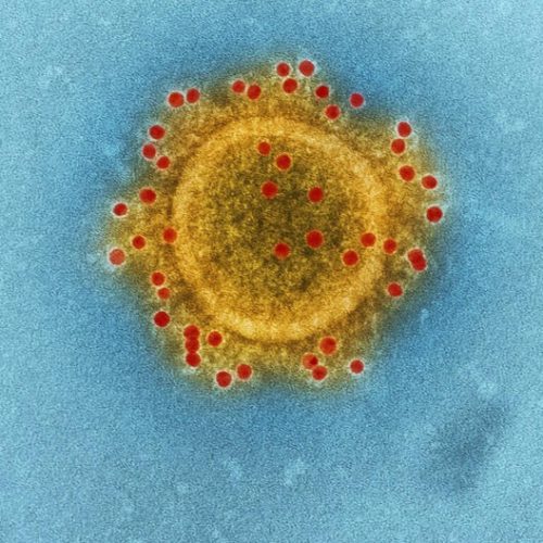 Το Ινστιτούτο Παστέρ προειδοποιεί: «Πανδημία χειρότερη της COVID αν μεταλλαχθεί ο ιός της γρίπης των πτηνών»