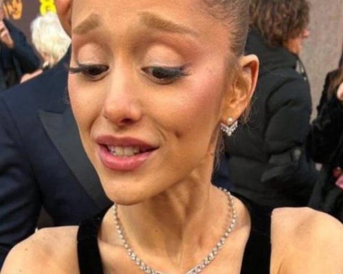 Ανησυχία στις τάξεις των θαυμαστών της Αριάνα Γκράντε μετά την εμφάνισή της στα βραβεία BAFTA