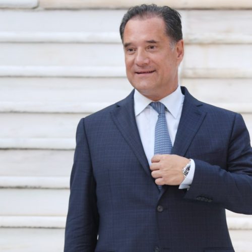 Άδωνις Γεωργιάδης: «Έκανα εμφύτευση μαλλιών, μπότοξ και χρησιμοποιώ κρέμες, αλλά όχι λίφτινγκ»