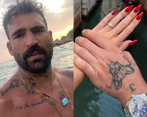 Δημήτρης Αλεξάνδρου: Έσβησε το τατουάζ που είχε κάνει για την Ιωάννα Τούνη στο χέρι του μετά τον χωρισμό τους