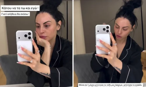 Η δραματική περιπέτεια της Δήμητρας Αλεξανδράκη με το αλλεργικό σοκ: “Παραμορφώθηκα, δεν ξέρω αν θα ξημερώσω” (Βίντεο)