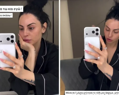 Η δραματική περιπέτεια της Δήμητρας Αλεξανδράκη με το αλλεργικό σοκ: “Παραμορφώθηκα, δεν ξέρω αν θα ξημερώσω” (Βίντεο)