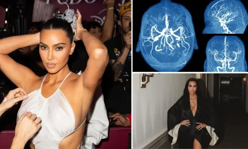 Κιμ Καρντάσιαν: “Υποβλήθηκα σε νέες εξετάσεις μετά το ανεύρυσμα – Το στρες και οι συνέπειες στον εγκέφαλό μου”