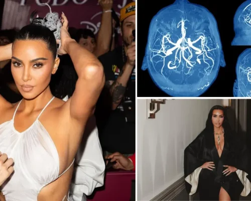 Κιμ Καρντάσιαν: “Υποβλήθηκα σε νέες εξετάσεις μετά το ανεύρυσμα – Το στρες και οι συνέπειες στον εγκέφαλό μου”
