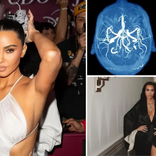 Κιμ Καρντάσιαν: “Υποβλήθηκα σε νέες εξετάσεις μετά το ανεύρυσμα – Το στρες και οι συνέπειες στον εγκέφαλό μου”