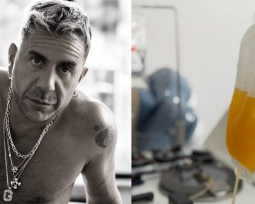 Πώς η πλασμαφαίρεση… αφαίρεσε τη ζωή από τον Γιώργο Μαζωνάκη – Το μοιραίο λάθος και η ανακοπή καρδιάς