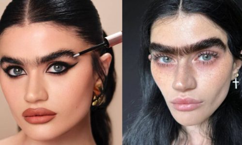 «Ozempic Face»: Ποιες επώνυμες το προτίμησαν – Οι αλλαγές στα πρόσωπά τους