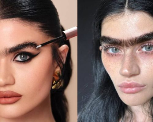 «Ozempic Face»: Ποιες επώνυμες το προτίμησαν – Οι αλλαγές στα πρόσωπά τους