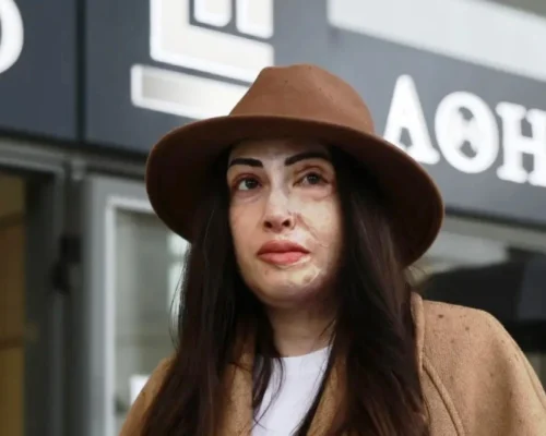 Ιωάννα Παλιοσπύρου: Γίνεται ντοκιμαντέρ η ζωή της και η επίθεση με βιτριόλι