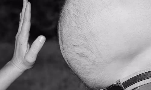 Ποιες ενέσεις; Νέο χάπι – «θαύμα» φέρνει επανάσταση στη θεραπεία της παχυσαρκίας