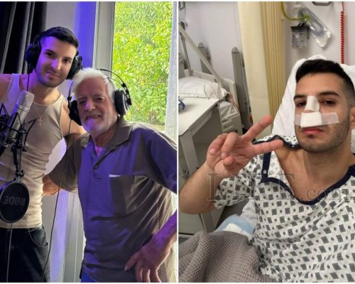 Σάββας Κων.: Το σοβαρό τροχαίο του Κύπριου TikToker και η πλαστική επέμβαση – Όσα λέει στο LIKE